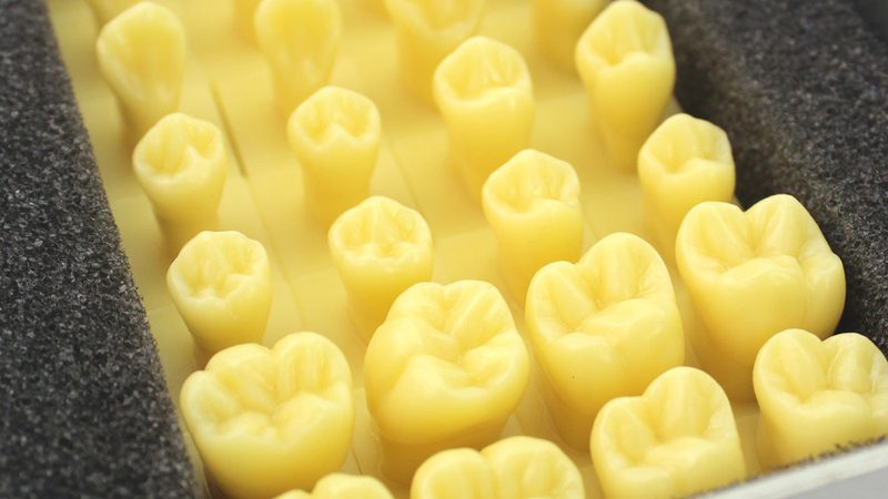 牙冠修复，树脂还是陶瓷？揭秘d打印技术的选择奥秘**
